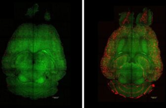 Scientists Just Reversed Alzheimer’s in Mice. Could They Do It in Humans?