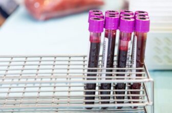 A Simple Blood Test Could Eventually Tell You When Alzheimer’s Is Coming